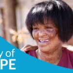 J_8y451al6c -burned Alive by Husband. Katie’s Inspirational Story of Hope and Truimph - U-witness.com by Witness