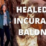 Ikmast-q5wg -healed of Alopecia Universalis and Baldness – Allyson Rola - U-witness.com by Witness