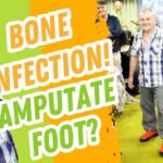 Akpzihsbvru -doctor Wanted to Amputate the Foot Due to Bone Infection After Surgery. - U-witness.com by Witness