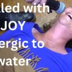 Gbda3cbhu9m -allergic to Everything, Even Water! in Danger of Dying from Malnutrition. Instantly Healed. - U-witness.com by Witness